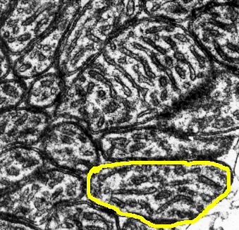 electron micrograph of mitochondria