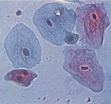 Stained human cheek cells