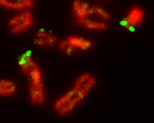 fluorescently labeld pseudoautosomal regions of X and Y chromosomes